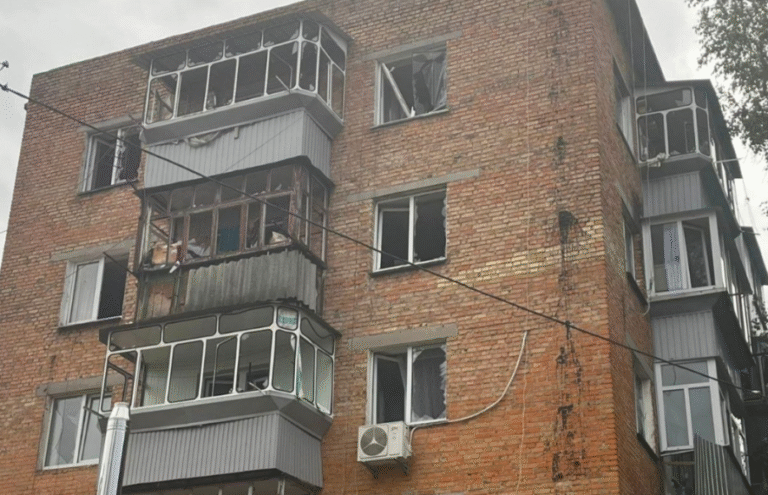 Київська область в попелищах: постраждалі в лікарнях після нових обстрілів РФ – ФОТО