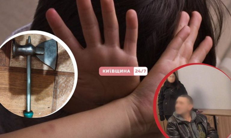 У Києві п’яний вітчим кухонним тесаком поранив 10‑річного хлопчика, який заступився за сестру