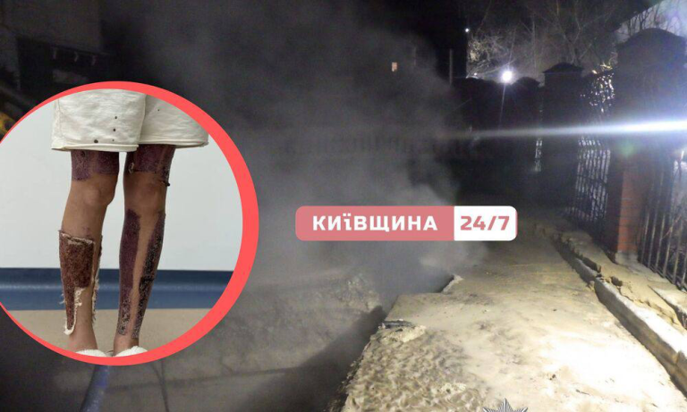 У Києві затримали посадовця «Київтеплоенерго» після інциденту, коли через службову недбалість дитина впала в яму з окропом