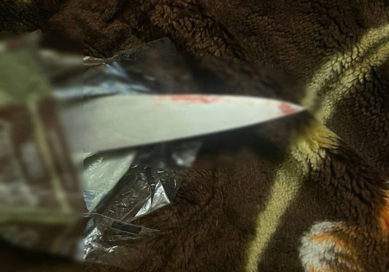 Ревнощі привели до лікарні — у Києві судитимуть чоловіка за ножове поранення нового партнера колишньої